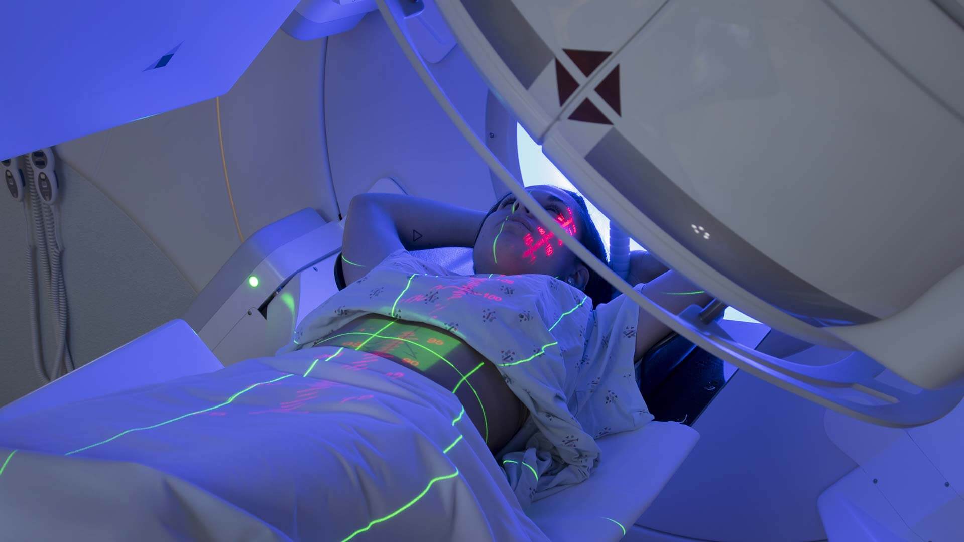 Terapias radio-oncología